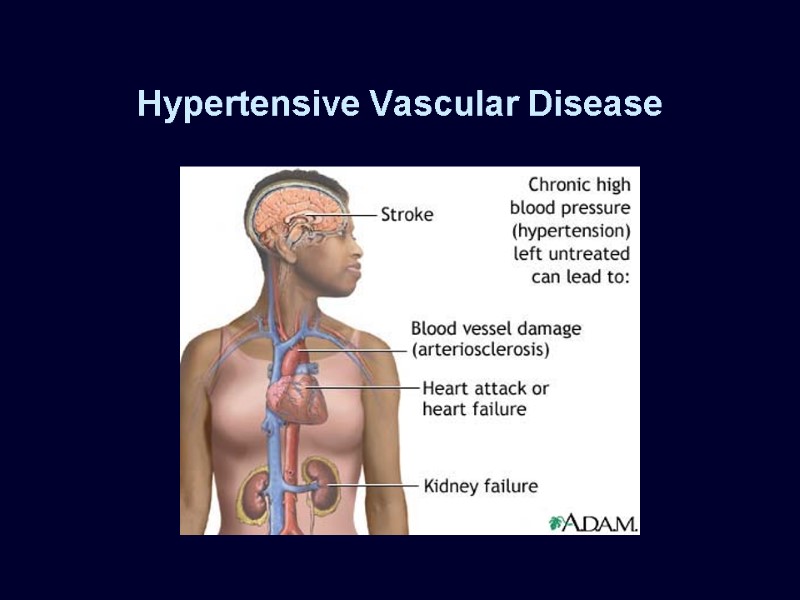 Hypertensive Vascular Disease